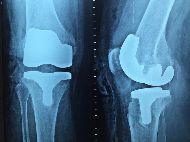 Ortho Fast Track recovery